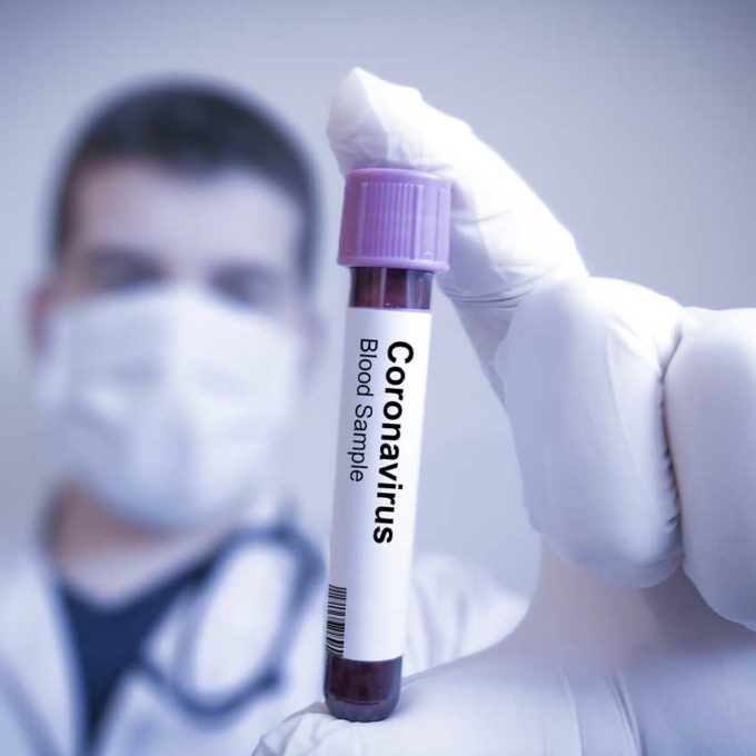 Coronavirus aktuelle Informationen beim Wechsel PKV zu GKV