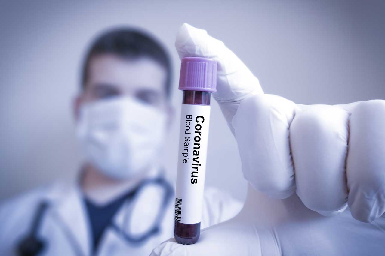 Coronavirus aktuelle Informationen beim Wechsel PKV zu GKV